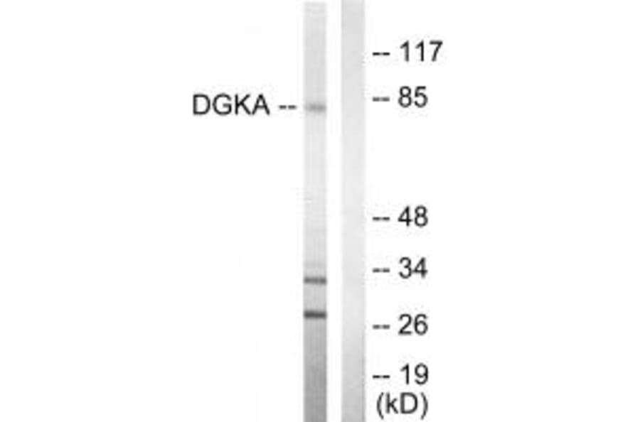Western blot - DGKA Antibody from Signalway Antibody (33723) - Antibodies.com