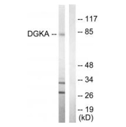 Western blot - DGKA Antibody from Signalway Antibody (33723) - Antibodies.com