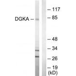 Western blot - DGKA Antibody from Signalway Antibody (33723) - Antibodies.com