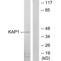 Western blot analysis of extracts from COLO205 cells, using KAP1 antibody #33747.
