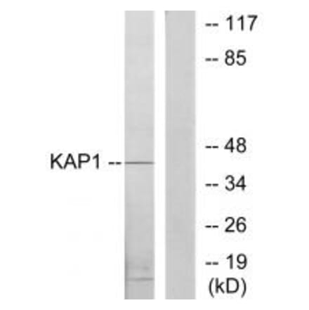Western blot - KAP1 Antibody from Signalway Antibody (33747) - Antibodies.com