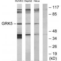 Western blot analysis of extracts from HUVEC cells, HepG2 cells and HeLa cells, using GRK5 antibody #33756.