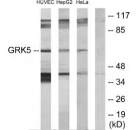 Western blot - GRK5 Antibody from Signalway Antibody (33756) - Antibodies.com