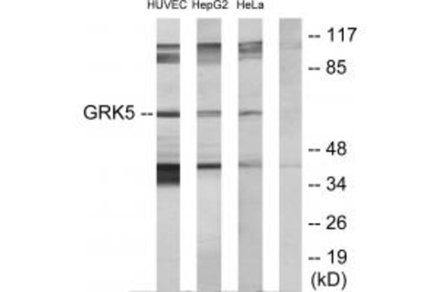 Western blot - GRK5 Antibody from Signalway Antibody (33756) - Antibodies.com