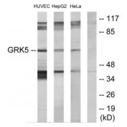 Western blot - GRK5 Antibody from Signalway Antibody (33756) - Antibodies.com