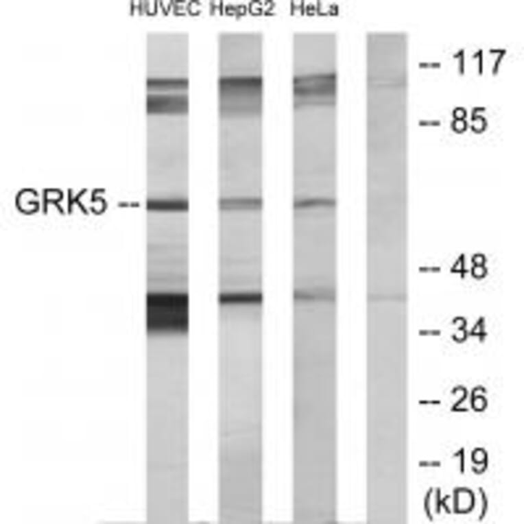 Western blot - GRK5 Antibody from Signalway Antibody (33756) - Antibodies.com