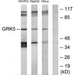 Western blot - GRK5 Antibody from Signalway Antibody (33756) - Antibodies.com