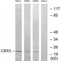 Western blot analysis of extracts from HUVEC cells, using CBX5 antibody #33774.