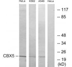 Western blot - CBX5 Antibody from Signalway Antibody (33774) - Antibodies.com