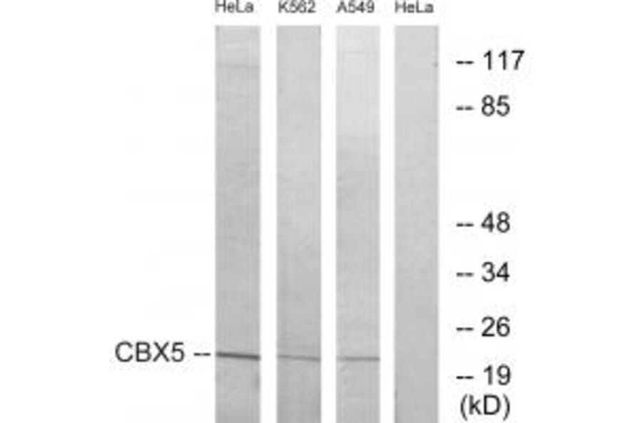 Western blot - CBX5 Antibody from Signalway Antibody (33774) - Antibodies.com