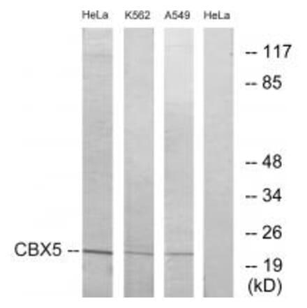 Western blot - CBX5 Antibody from Signalway Antibody (33774) - Antibodies.com