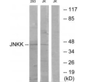 Western blot - JNKK Antibody from Signalway Antibody (33775) - Antibodies.com