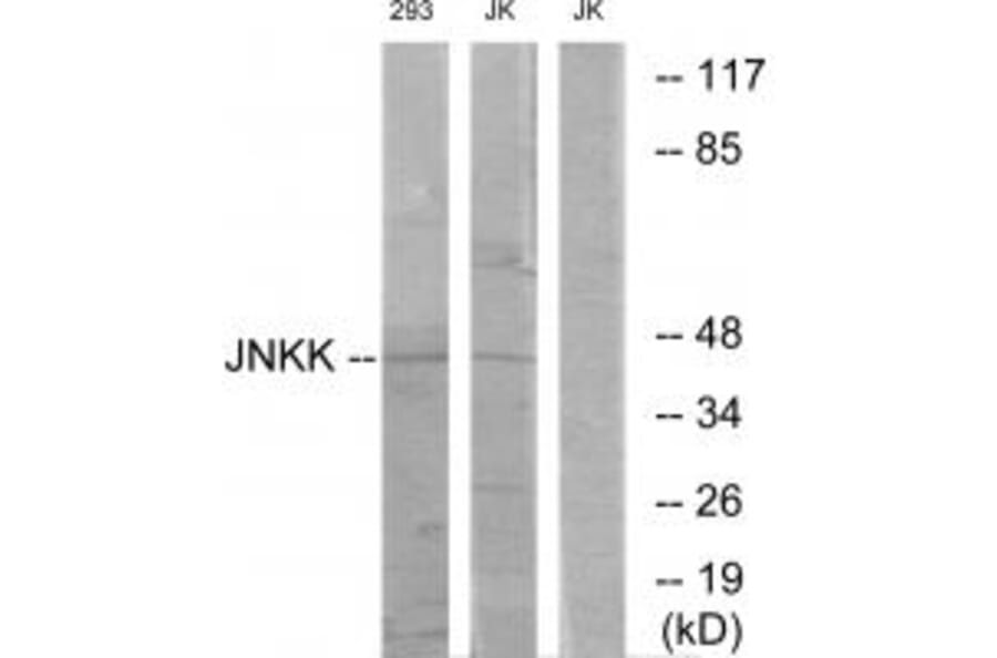 Western blot - JNKK Antibody from Signalway Antibody (33775) - Antibodies.com