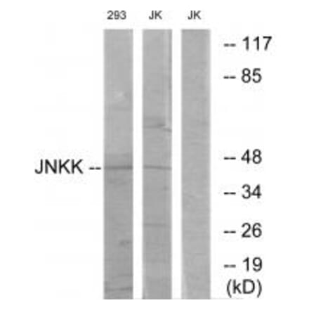 Western blot - JNKK Antibody from Signalway Antibody (33775) - Antibodies.com