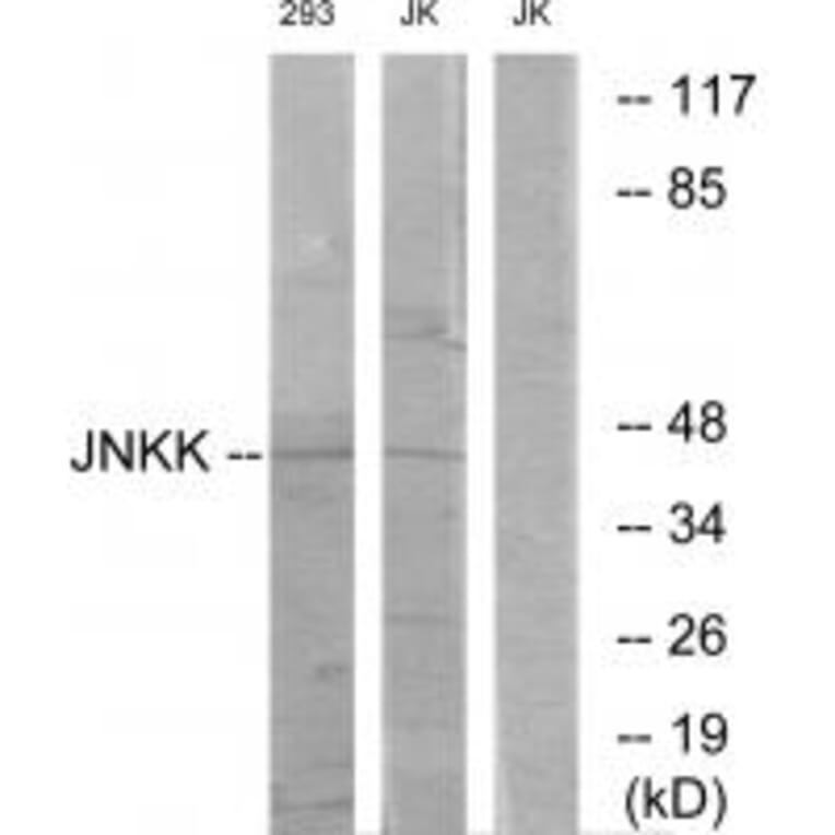 Western blot - JNKK Antibody from Signalway Antibody (33775) - Antibodies.com