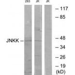 Western blot - JNKK Antibody from Signalway Antibody (33775) - Antibodies.com