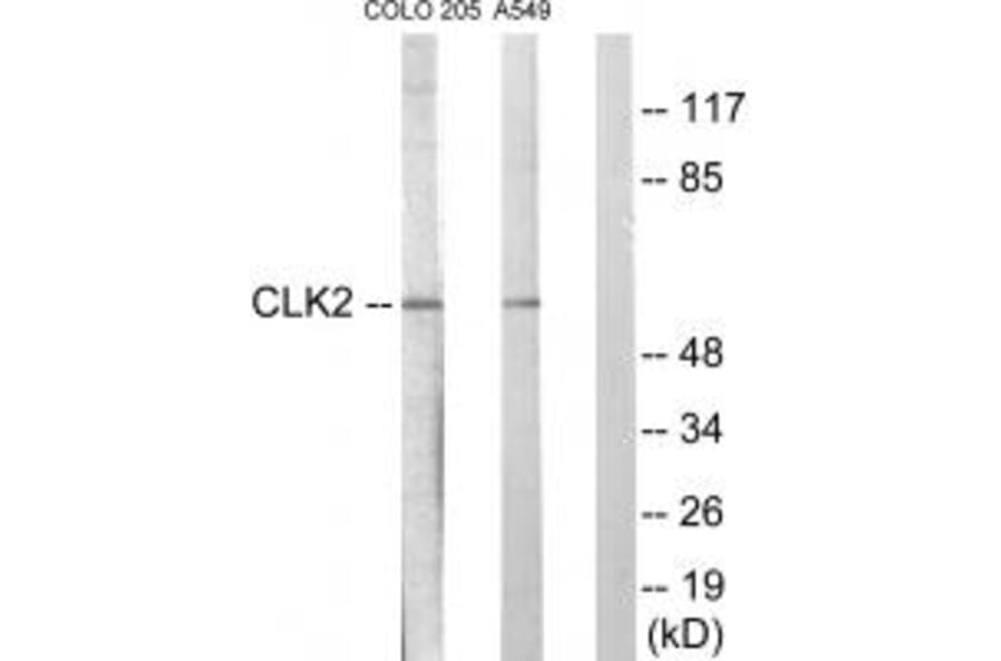 Western blot - CLK2 Antibody from Signalway Antibody (33785) - Antibodies.com