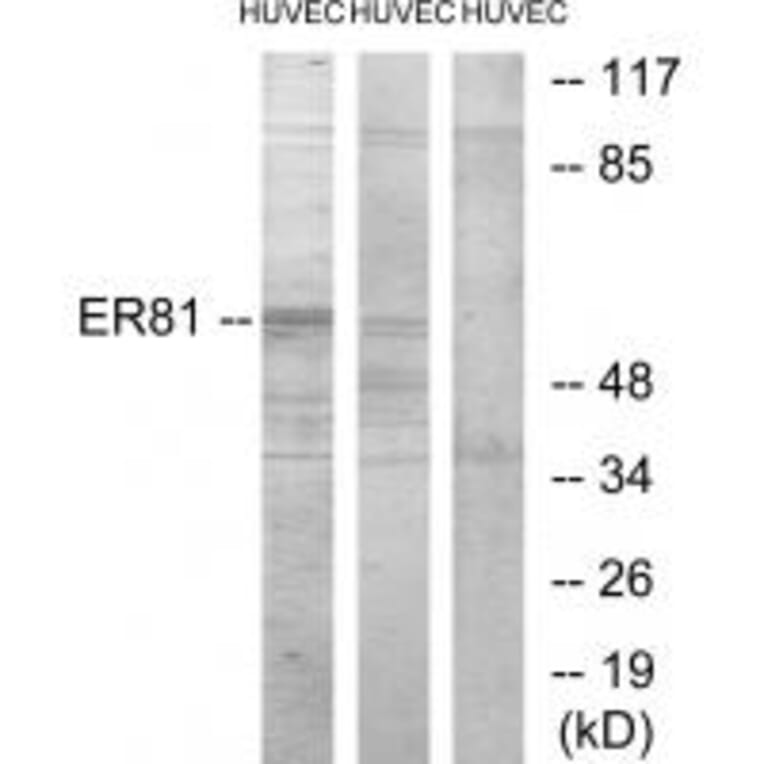 Western blot - ER81 Antibody from Signalway Antibody (33791) - Antibodies.com