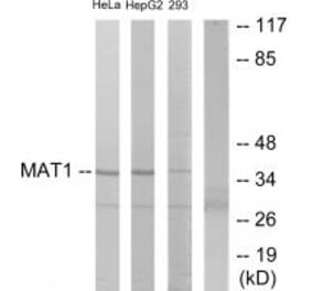 Western blot - MAT1 Antibody from Signalway Antibody (33801) - Antibodies.com