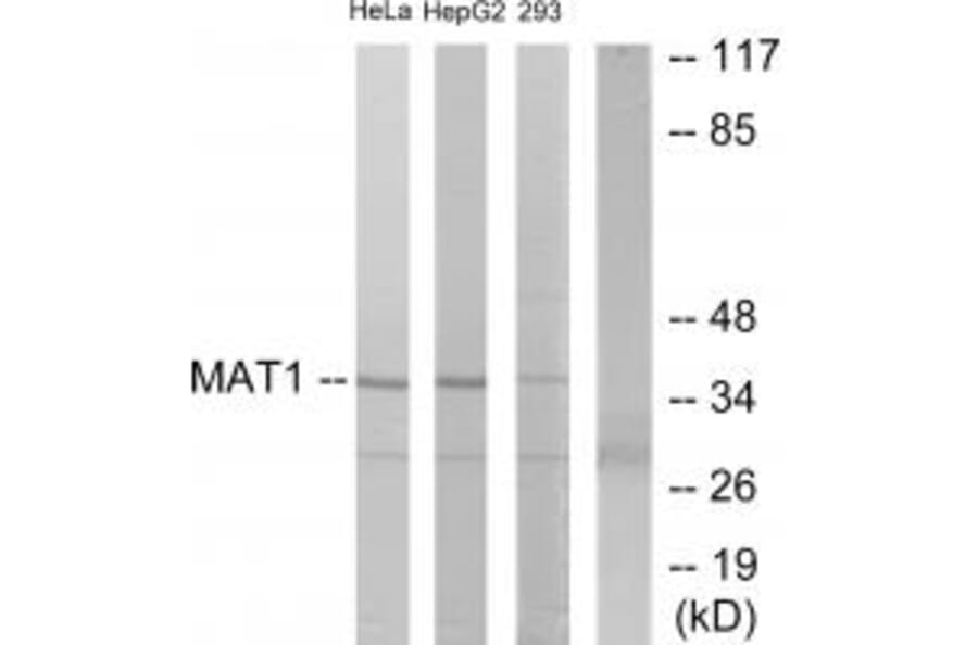 Western blot - MAT1 Antibody from Signalway Antibody (33801) - Antibodies.com