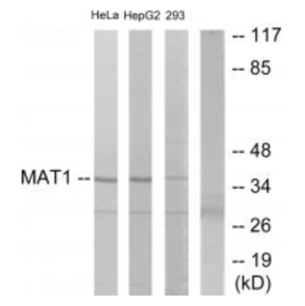 Western blot - MAT1 Antibody from Signalway Antibody (33801) - Antibodies.com