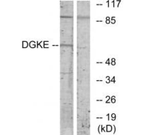 Western blot - DGKE Antibody from Signalway Antibody (33803) - Antibodies.com