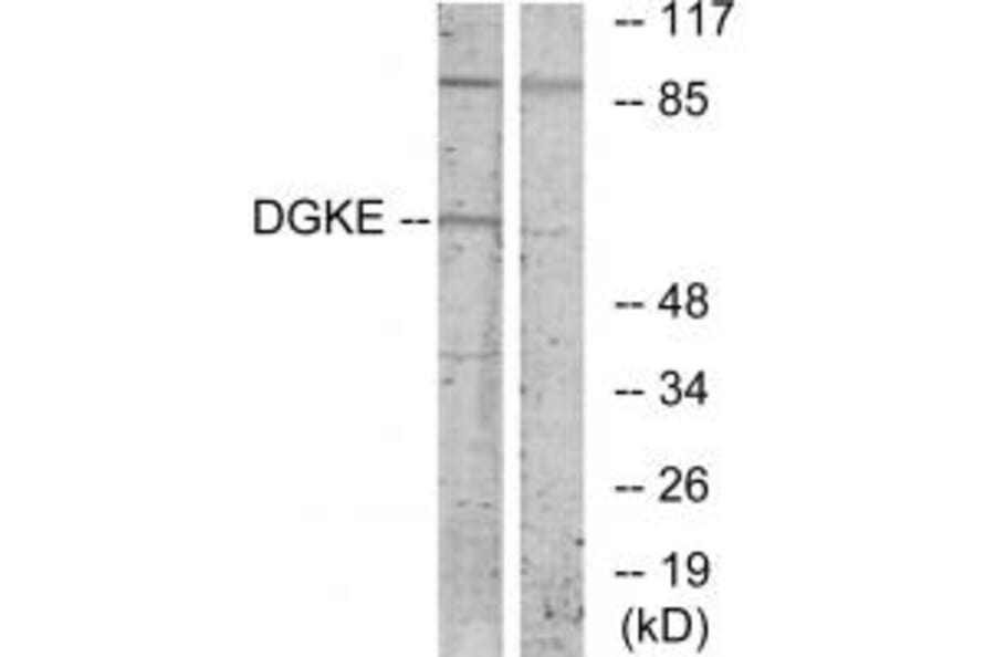 Western blot - DGKE Antibody from Signalway Antibody (33803) - Antibodies.com
