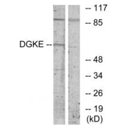 Western blot - DGKE Antibody from Signalway Antibody (33803) - Antibodies.com
