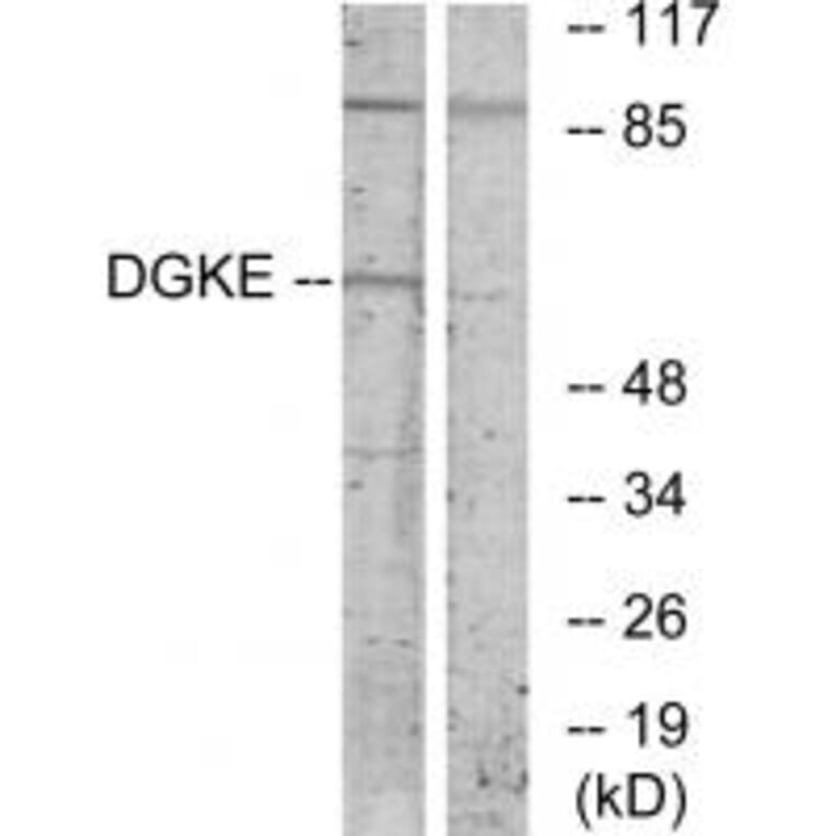 Western blot - DGKE Antibody from Signalway Antibody (33803) - Antibodies.com