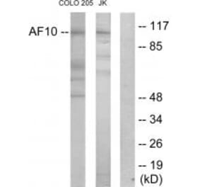 Western blot - AF10 Antibody from Signalway Antibody (33820) - Antibodies.com