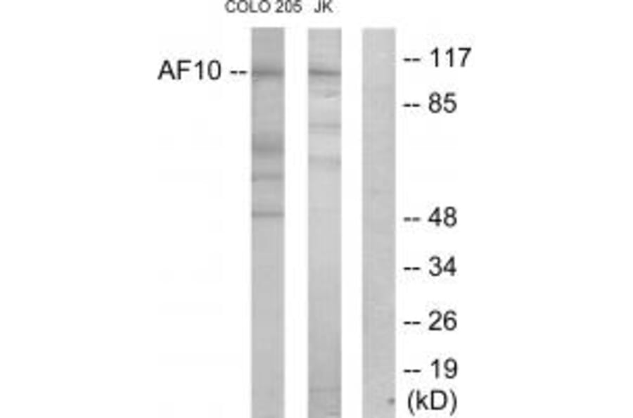Western blot - AF10 Antibody from Signalway Antibody (33820) - Antibodies.com