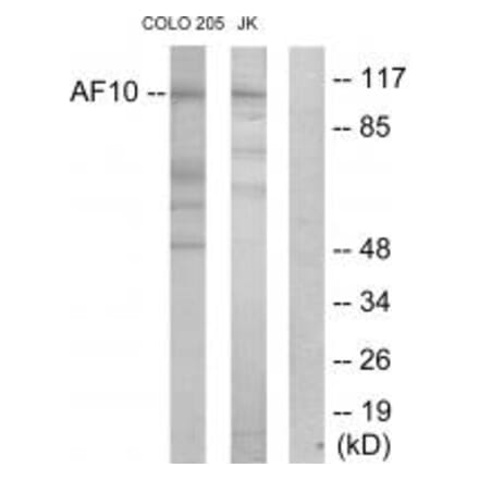 Western blot - AF10 Antibody from Signalway Antibody (33820) - Antibodies.com