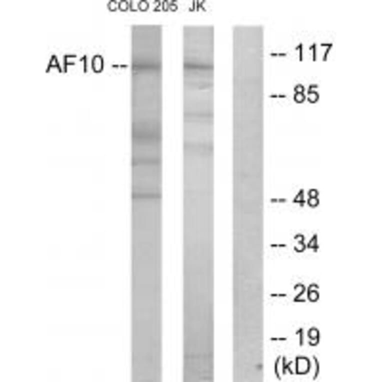 Western blot - AF10 Antibody from Signalway Antibody (33820) - Antibodies.com