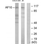 Western blot - AF10 Antibody from Signalway Antibody (33820) - Antibodies.com