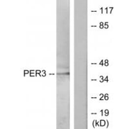 Western blot - PER3 Antibody from Signalway Antibody (33826) - Antibodies.com