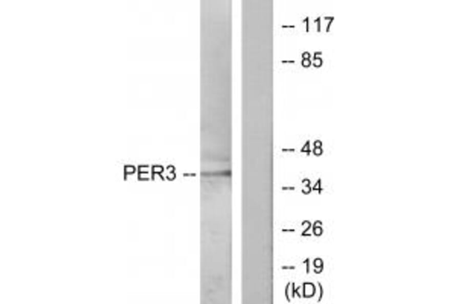 Western blot - PER3 Antibody from Signalway Antibody (33826) - Antibodies.com