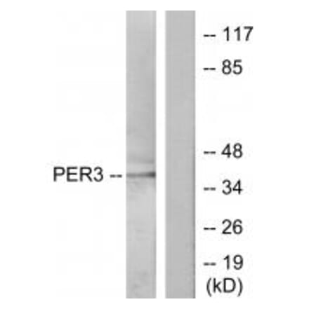 Western blot - PER3 Antibody from Signalway Antibody (33826) - Antibodies.com