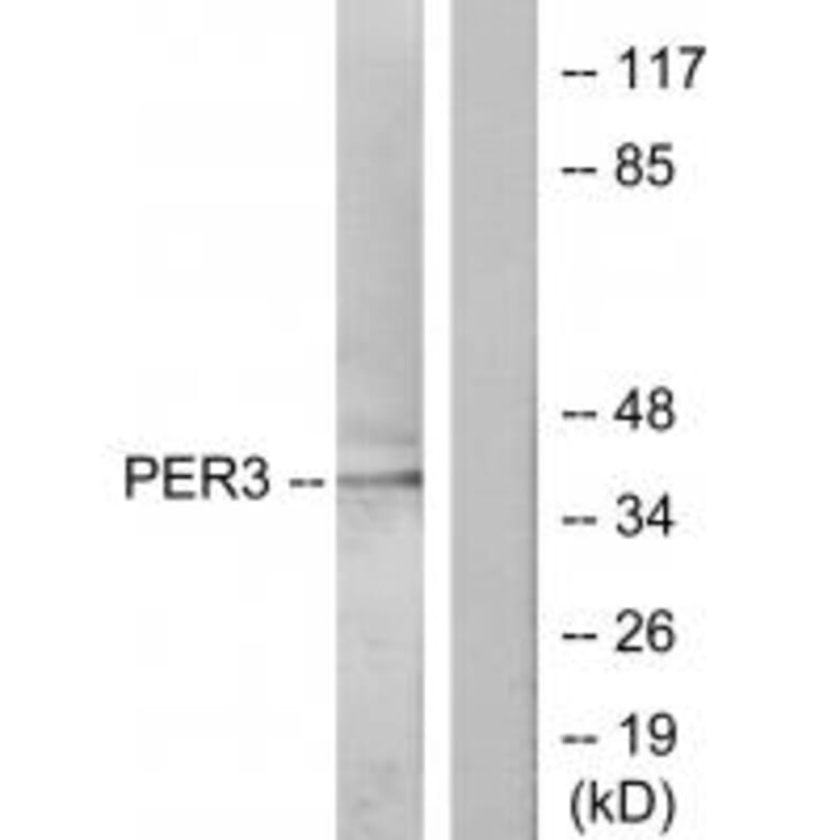 Western blot - PER3 Antibody from Signalway Antibody (33826) - Antibodies.com