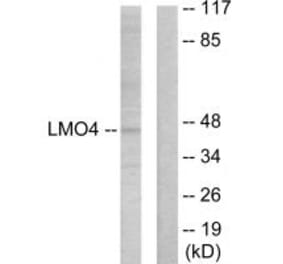 Western blot - LMO4 Antibody from Signalway Antibody (33833) - Antibodies.com