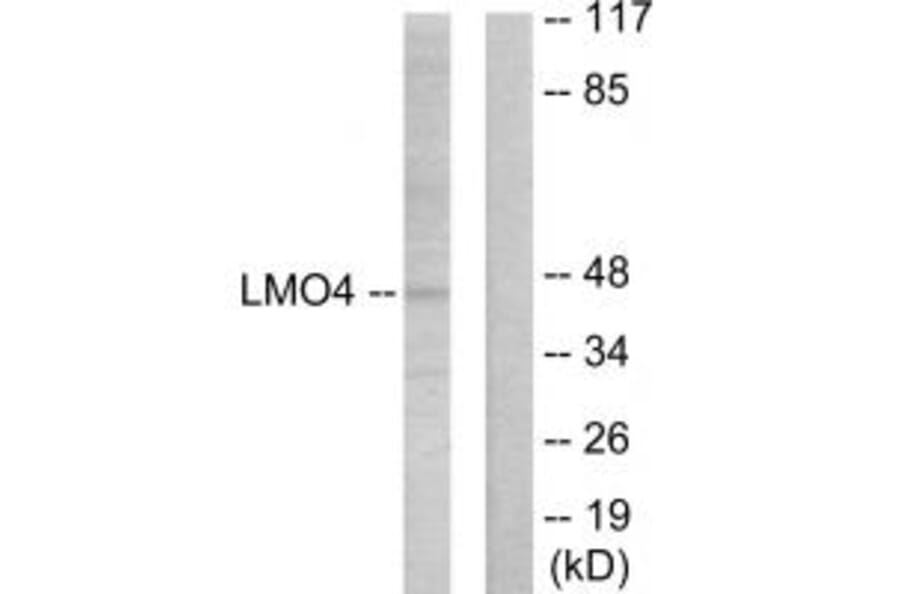 Western blot - LMO4 Antibody from Signalway Antibody (33833) - Antibodies.com