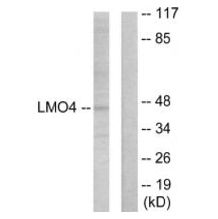 Western blot - LMO4 Antibody from Signalway Antibody (33833) - Antibodies.com