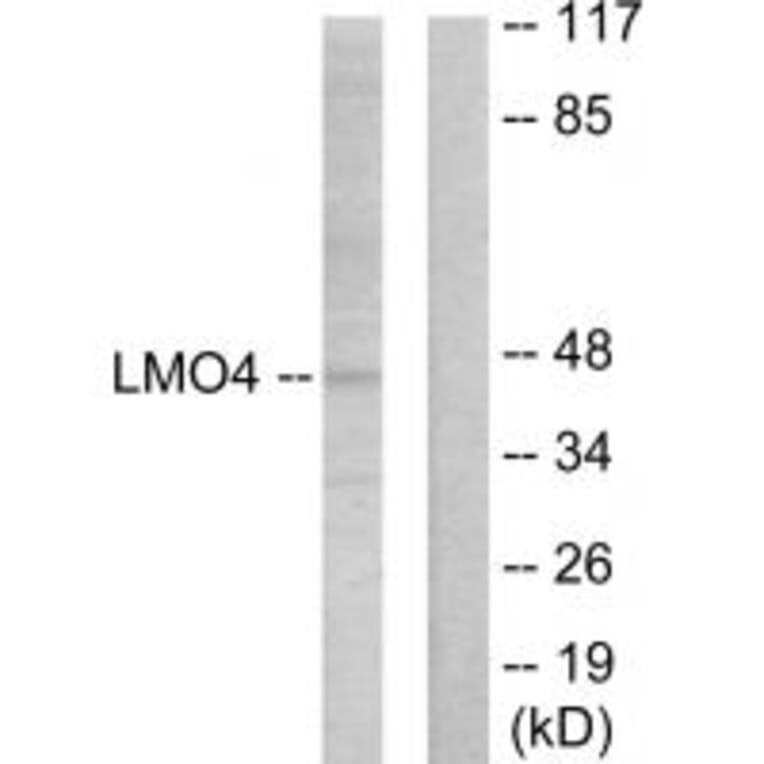 Western blot - LMO4 Antibody from Signalway Antibody (33833) - Antibodies.com