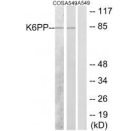 Western blot - K6PP Antibody from Signalway Antibody (33843) - Antibodies.com