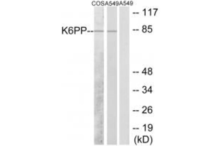 Western blot - K6PP Antibody from Signalway Antibody (33843) - Antibodies.com
