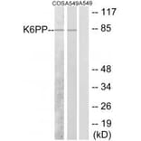 Western blot - K6PP Antibody from Signalway Antibody (33843) - Antibodies.com