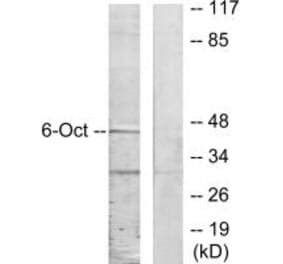 Western blot - OCT6 Antibody from Signalway Antibody (33849) - Antibodies.com