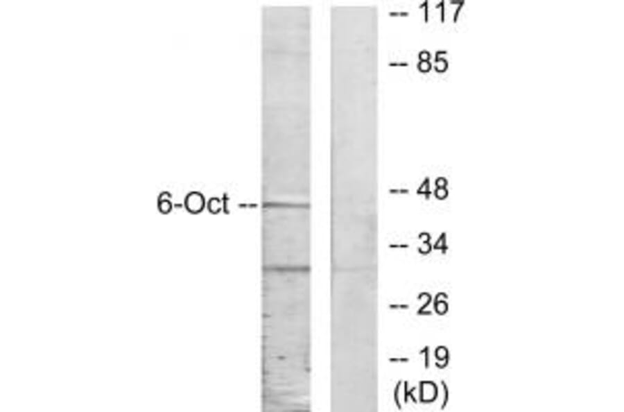 Western blot - OCT6 Antibody from Signalway Antibody (33849) - Antibodies.com