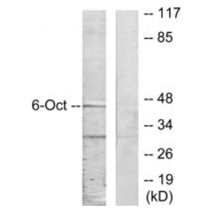 Western blot - OCT6 Antibody from Signalway Antibody (33849) - Antibodies.com