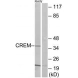 Western blot - CREM Antibody from Signalway Antibody (33850) - Antibodies.com