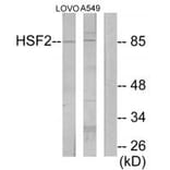 Western blot - HSF2 Antibody from Signalway Antibody (33854) - Antibodies.com